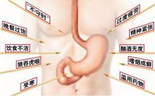 嗜酸性粒细胞性胃肠炎--病理 嗜酸性粒细胞性胃肠炎--病理