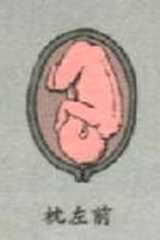 左枕前位 左枕前位