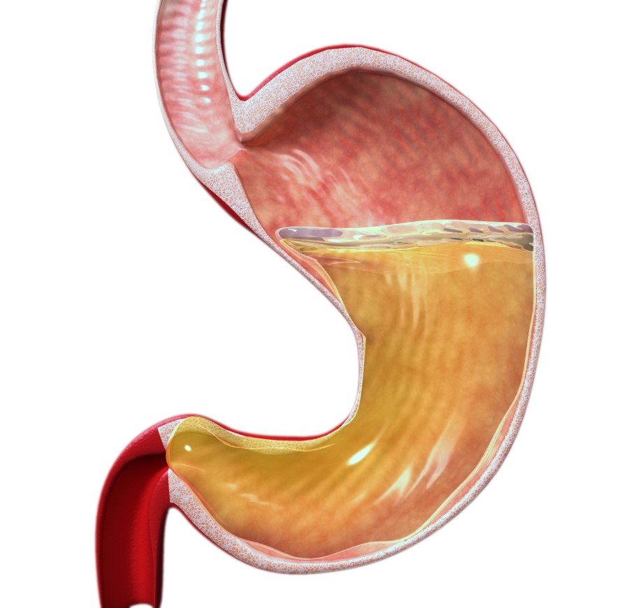 gastric fluid